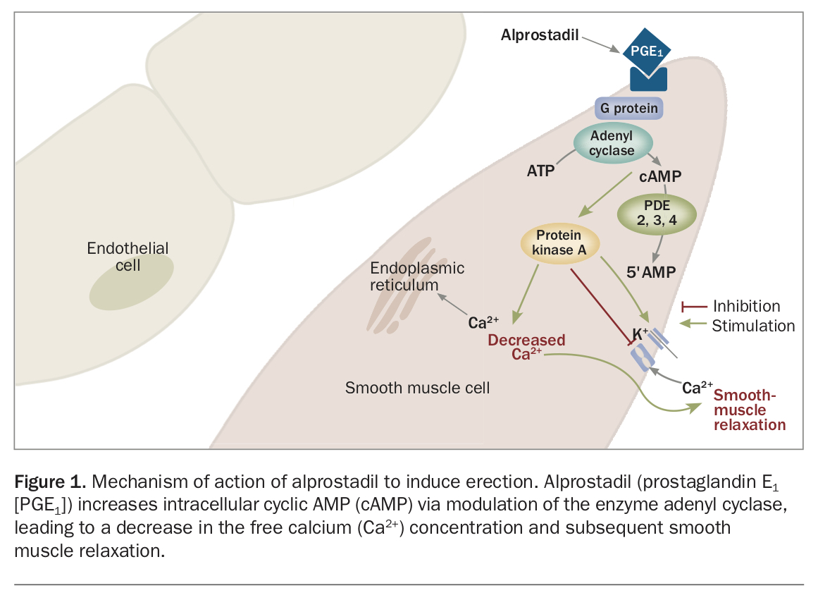 Erectile dysfunction. Part 2 Management of ED unresponsive to